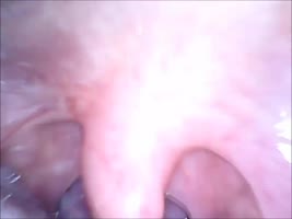 Cam in mouth vagina and extreme ass closup