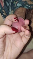FetishFantazy's Nurse Torment: Red Nails Squeeze Peehole & Cock Leaks Precum